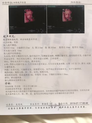 24周四维彩超,说是女孩,翻盘的几率还有吗?那位朋友懂得帮忙看一下!