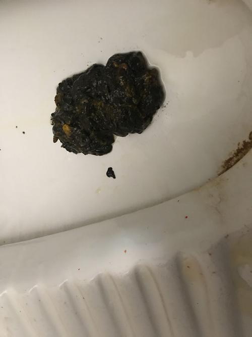 拉黑便怎么回事