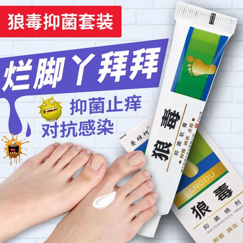狼毒脚气喷剂脚气软膏脚痒脱皮去除脚臭脚汗烂脚丫膏