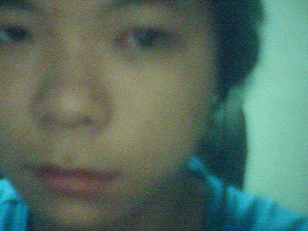 为什么斜视手术后感觉眼位不正呢!