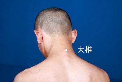 低头有3个棘突,分别哪三个?