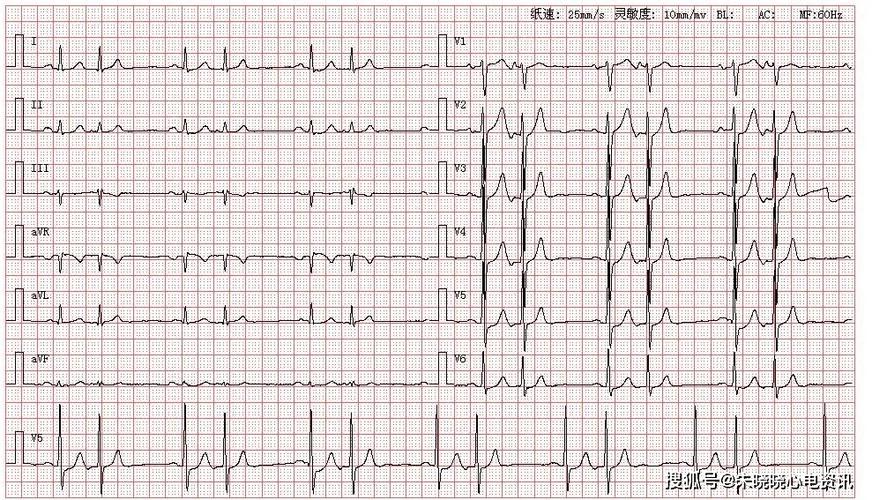 每日读图第1049期房早二联律