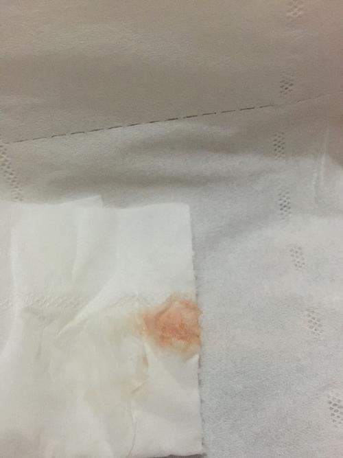 怀孕33天,孕酮,促绒毛膜性腺激素都检查正常,上厕所纸