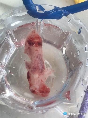 移植生化后来例假,流出白色的肉,好像是绒毛组织