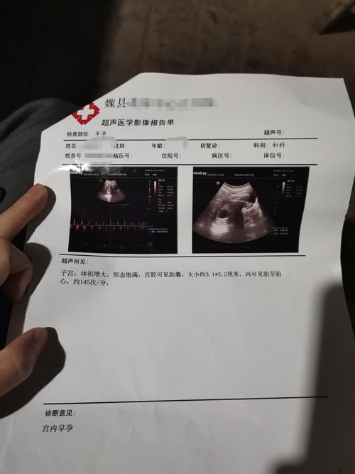 晓雨怀孕的影像报告单.受访者供图