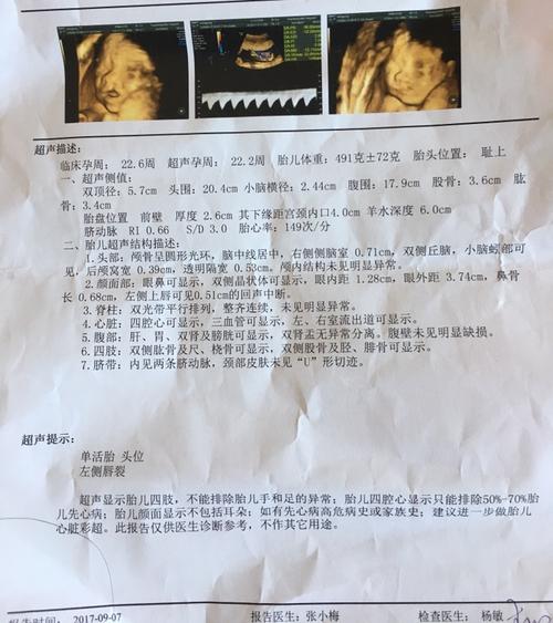 四维检查单 医生说唇裂 好像拍得挺清楚的 有必要复查