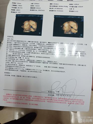 22周四维彩超,本想套医生是男是女,可整