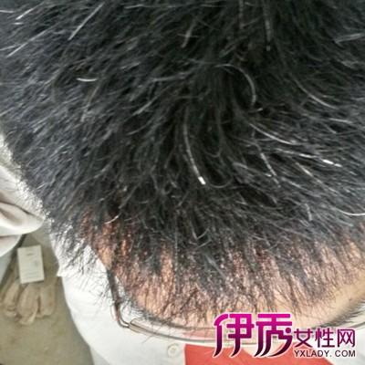 【图】昨梦见后脑勺长了好多白头发 梦见白发预示将会长寿