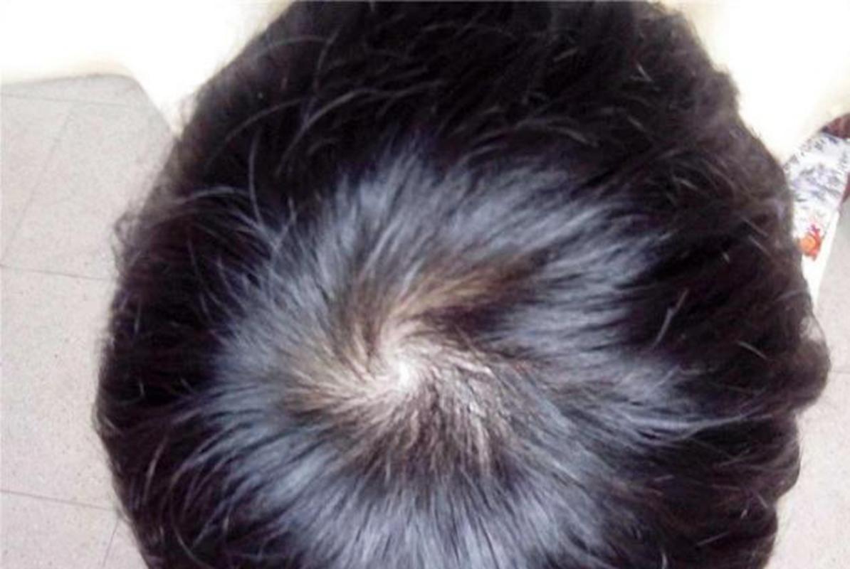 原创头顶两个"旋"的孩子最聪明?看看美国专家的调查,结果意想不到