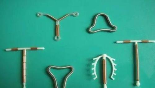 生完2个,你想让我上环,我想让你结扎!