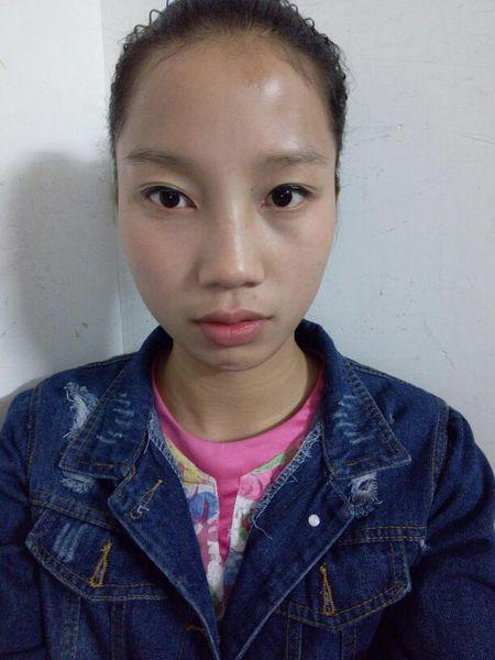 长脸额头高窄,下面颧骨高,脸宽又长,女,怎么办