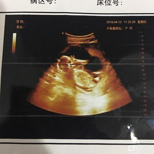 15周bc是女宝宝,吃手指好可爱