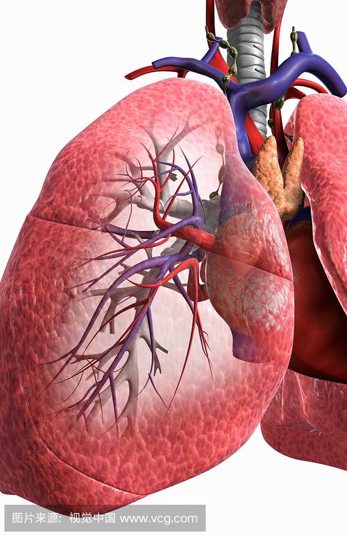 他被诊断为支气管扩张5年,肺已经千疮百孔,我为他找到