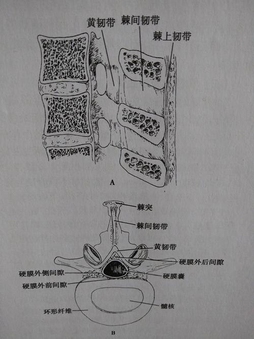 腰椎穿刺术及训练模型