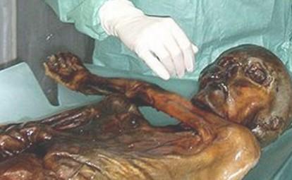 局,市卫生局等部门参加的联合调查组,就"救助站男孩死亡"一事展开调查