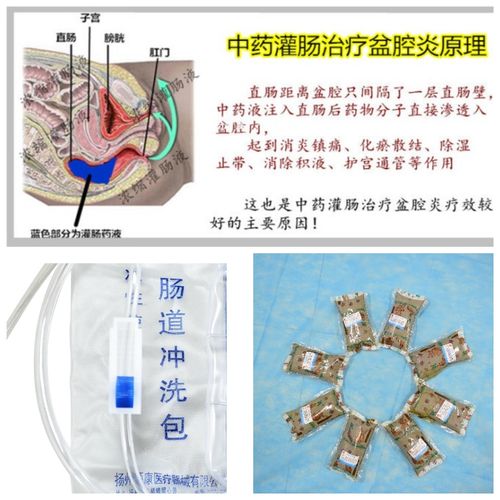 成人中药直肠给药治疗溃疡性结肠炎,妇科炎症,便秘,腹泻,痔疮等.