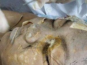 医学院学生解剖年轻裸体女尸现场