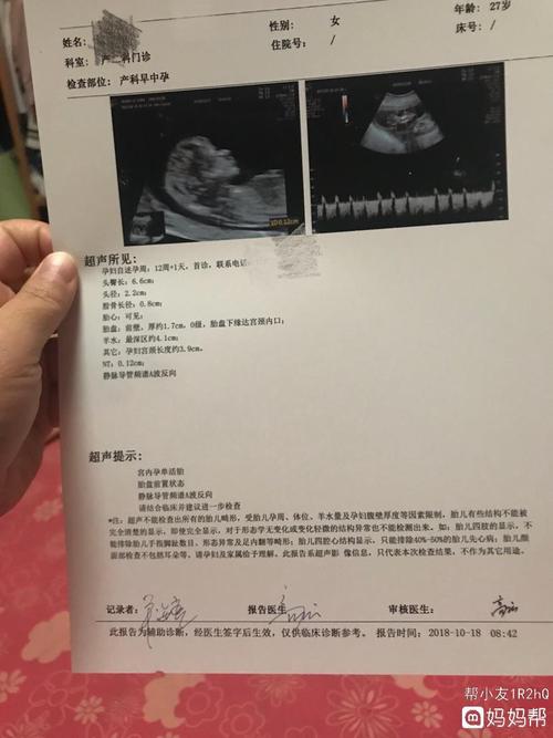 昨天做的nt检查,发现静脉导管频谱a波反向,有同样的准