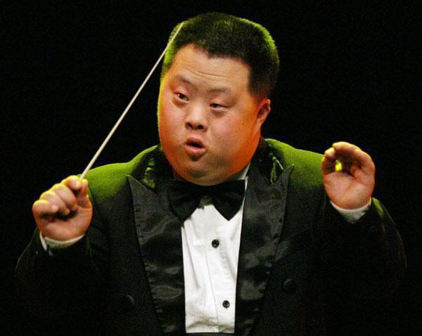 为什么唐氏综合征的孩子没有遗传父母的样貌长得都差不多