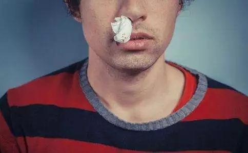 mds患者鼻子出血止血要适当!