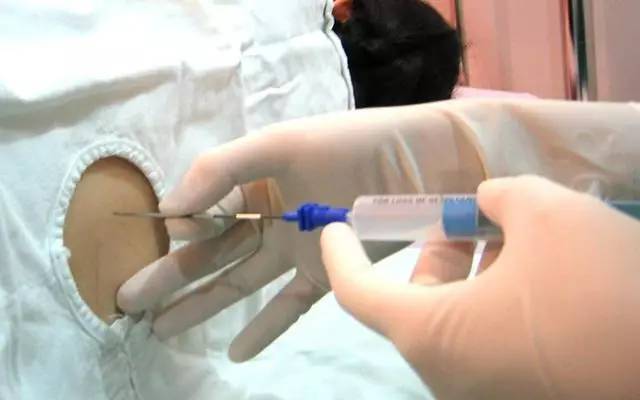 原来剖腹产用的麻醉针竟然有10cm长看完真的心疼妈妈一万遍