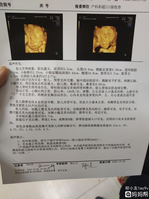 怀孕日记##四维彩超