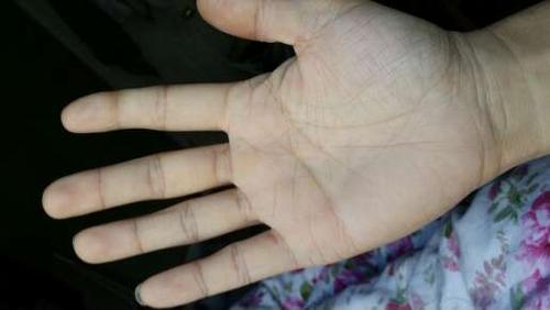 [android]请问这是肝掌吗