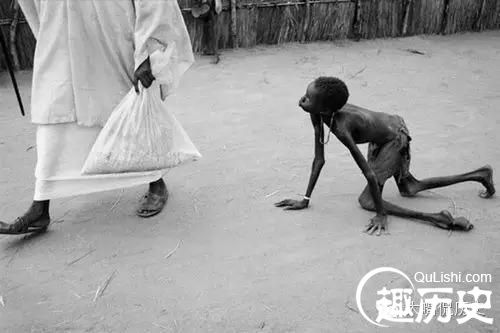 在无国界医生的营地里,这位骨瘦如柴,奄奄一息的男孩排队领到了他的