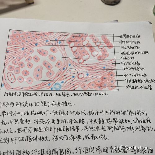 病理学红蓝铅笔手绘图