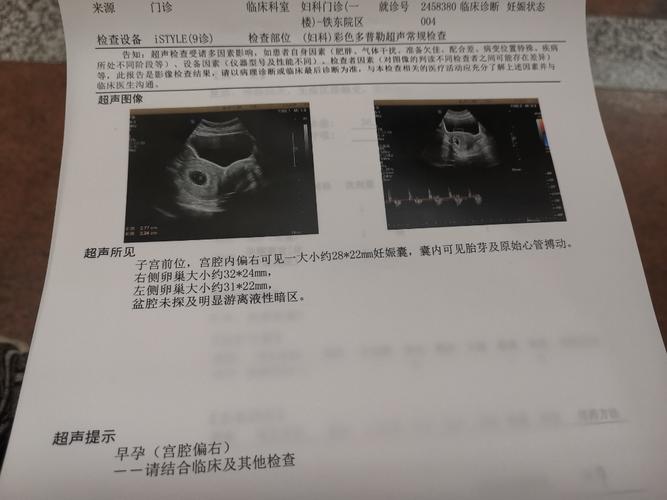 真的是宫角妊娠么?还能不能要了?