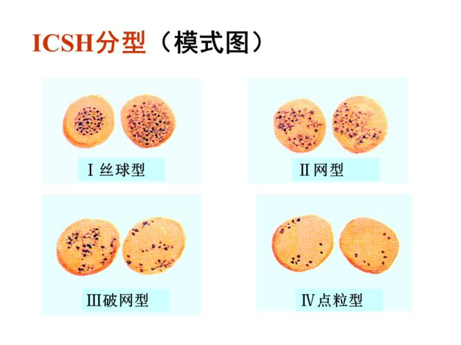 《网织红细胞计数》ppt课件.ppt