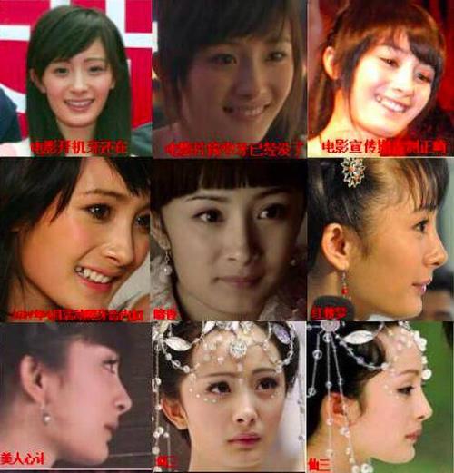 杨幂这些整容后遗症告诉你,不断返厂重修,代价得不偿失