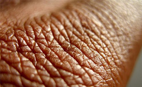 改善皮肤皱纹和毛孔问题