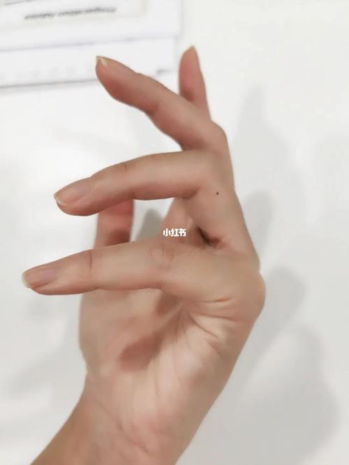 无名指痣_医疗健康