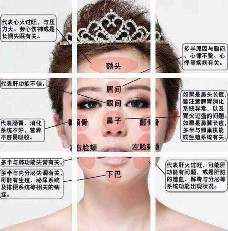 脸颊,颌骨长痘怎么调理