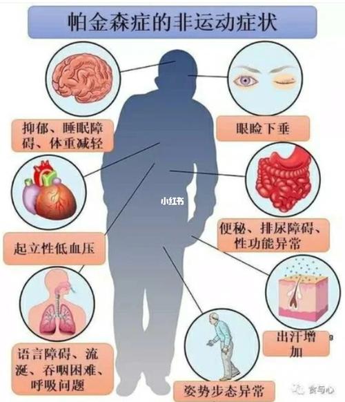 "帕金森病的的病因及症状"_修复受损_抑郁症_便秘_微信_舞蹈_医疗健康