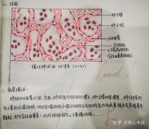病理学红蓝铅笔手绘图 实验报告病变描述