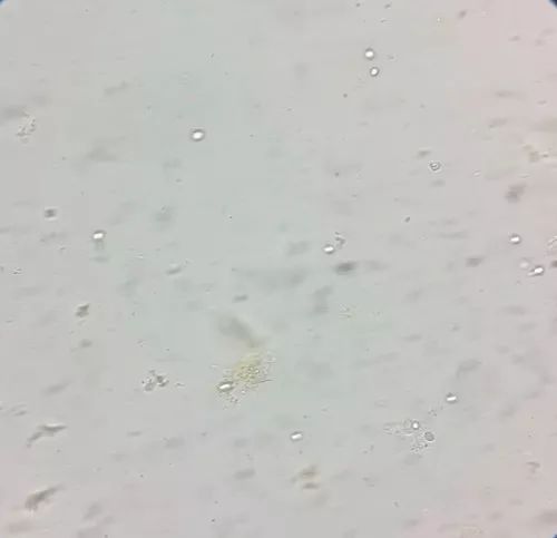 天呐,女儿大便里竟然有"霉菌"