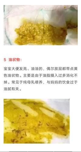 黑便,奶瓣,绿便,腹泻,便秘.宝宝的各种便便真图全解!建议收藏
