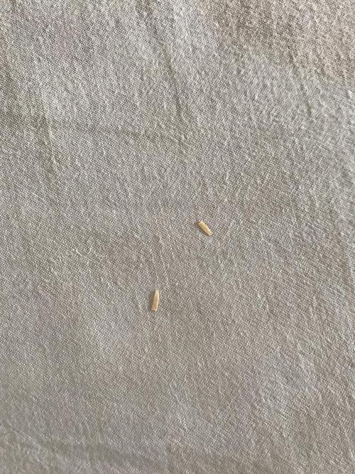 求助请问这是绦虫节片吗