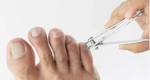 "肾"好不好看脚,若脚上没有这3个"症状",肾脏很健康