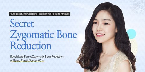 why do i want to introduce secret zygomatic bone reduction?