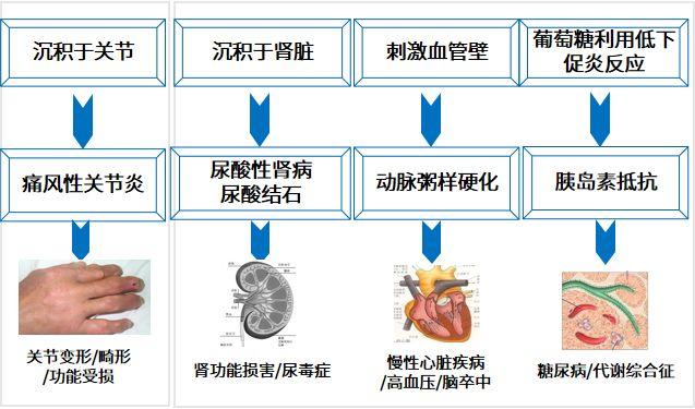 无症状高尿酸血症要不要治疗?