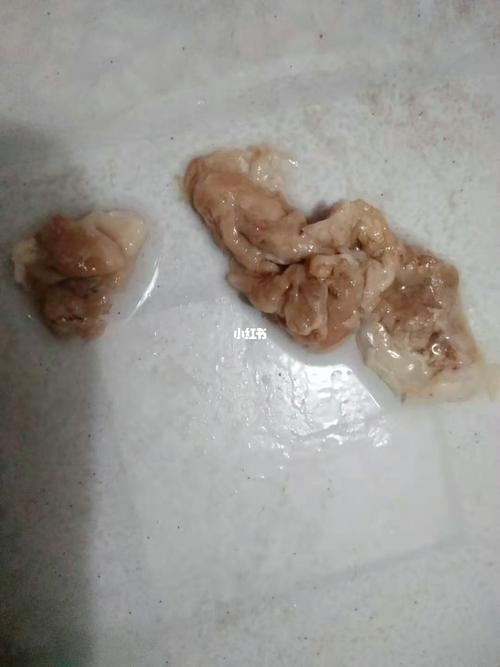 霉菌宫颈糜烂的看过来_宫颈糜烂_排出毒素_霉菌与滴虫