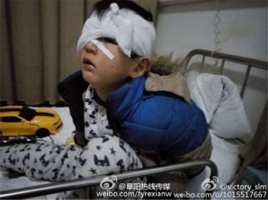 七岁男孩眼睛被人抠瞎摘除 行凶者疑心智不全