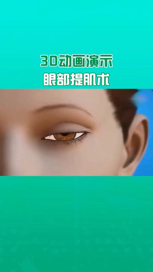 3d动画演示眼部提肌术_双眼皮手术_眼部_动画_全切双眼皮_美妆_医美