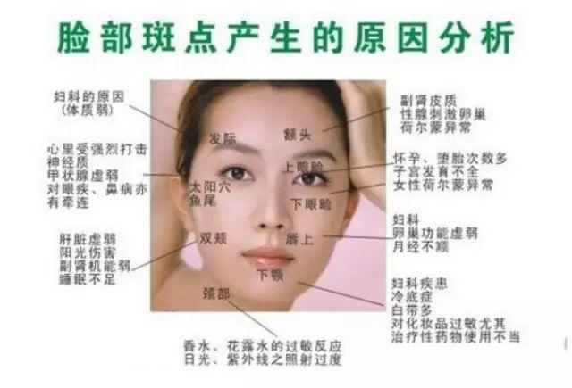 【美丽田园】女人脸上长斑?当心是妇科疾病!