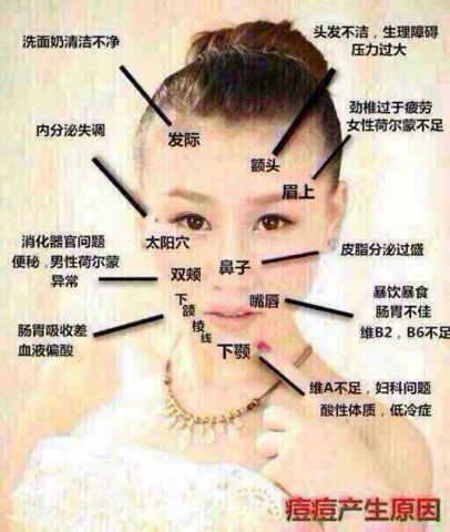 女生额头发际线位置长痘痘很严重 请问是什么原因造成的?该怎么护理?