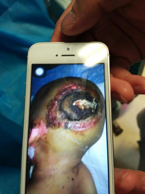 我的家庭贫穷为了给孩子治病把家里所有的积蓄都用了.