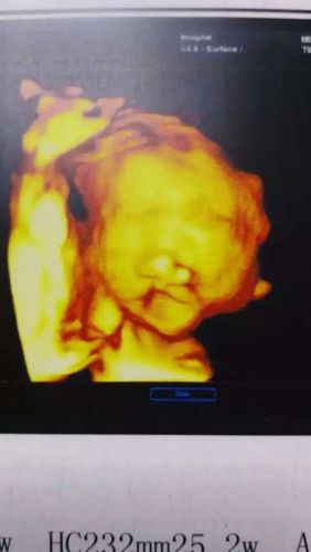 24周的四维彩超宝宝好丑 不忍直视